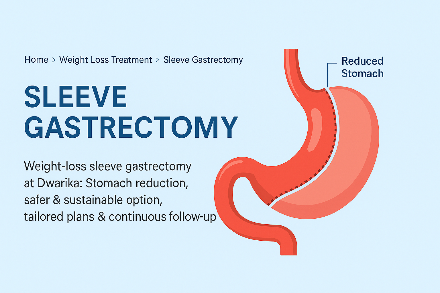 Sleeve Gastrectomy at Dwarika Hospital Ahmedabad